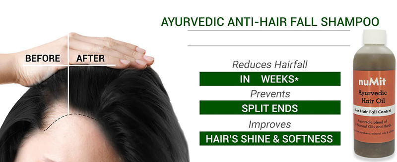 Buy nuMit Ayurvedic Hair Oil - Hair Fall Control Online | Faithful to ...